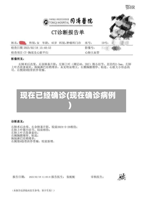现在已经确诊(现在确诊病例)