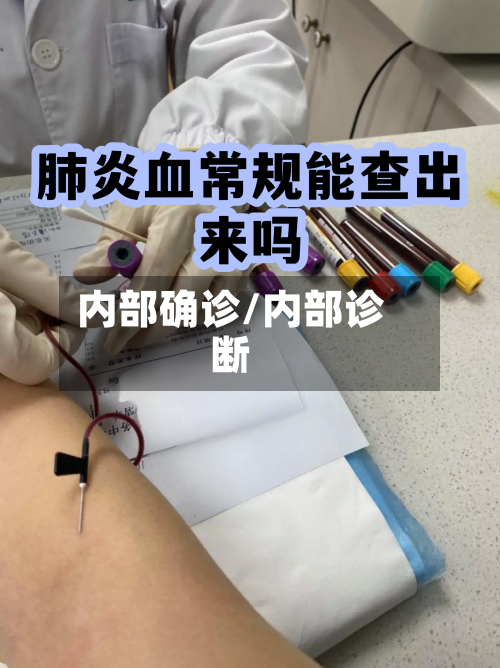 内部确诊/内部诊断-第2张图片