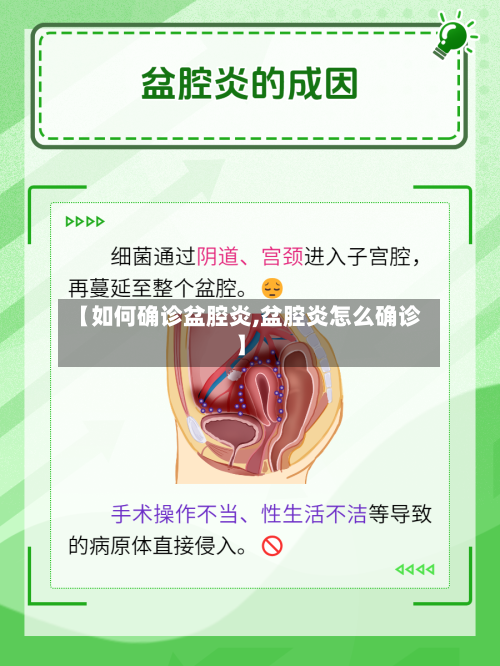 【如何确诊盆腔炎,盆腔炎怎么确诊】