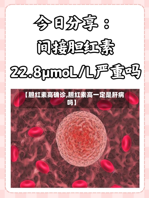 【胆红素高确诊,胆红素高一定是肝病吗】-第2张图片