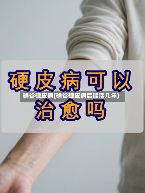 确诊硬皮病(确诊硬皮病后能活几年)-第3张图片