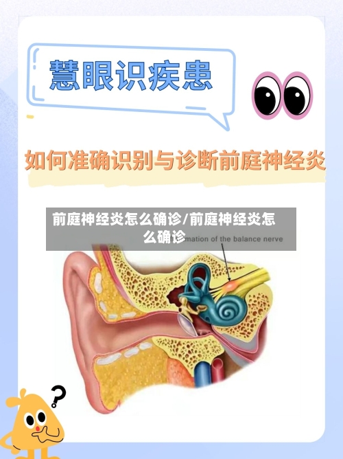 前庭神经炎怎么确诊/前庭神经炎怎么确诊-第3张图片