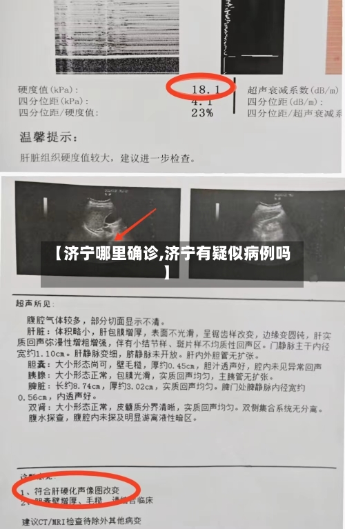 【济宁哪里确诊,济宁有疑似病例吗】
