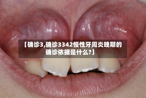 【确诊3,确诊3342慢性牙周炎晚期的确诊依据是什么?】
