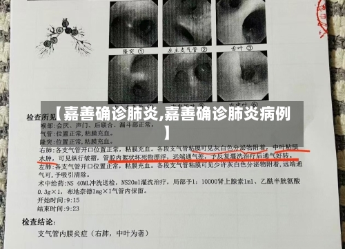 【嘉善确诊肺炎,嘉善确诊肺炎病例】