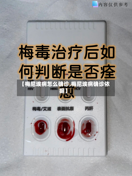 【梅尼埃病怎么确诊,梅尼埃病确诊依据】-第3张图片