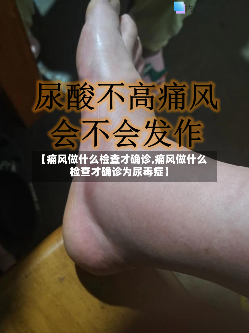 【痛风做什么检查才确诊,痛风做什么检查才确诊为尿毒症】-第3张图片