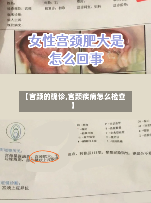 【宫颈的确诊,宫颈疾病怎么检查】