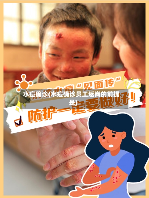 水痘确诊(水痘确诊员工返岗的前提是)-第3张图片