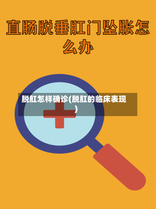 脱肛怎样确诊(脱肛的临床表现)