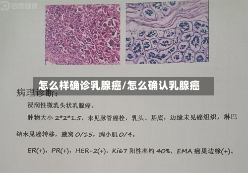 怎么样确诊乳腺癌/怎么确认乳腺癌-第2张图片