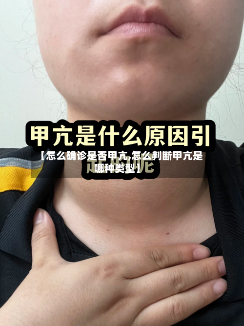 【怎么确诊是否甲亢,怎么判断甲亢是哪种类型】-第2张图片