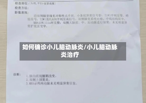 如何确诊小儿脑动脉炎/小儿脑动脉炎治疗